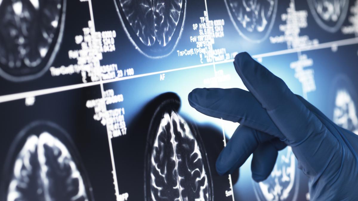 Los investigadores allanan el camino hacia frenar el envejecimiento cerebral al dar con una proteína clave