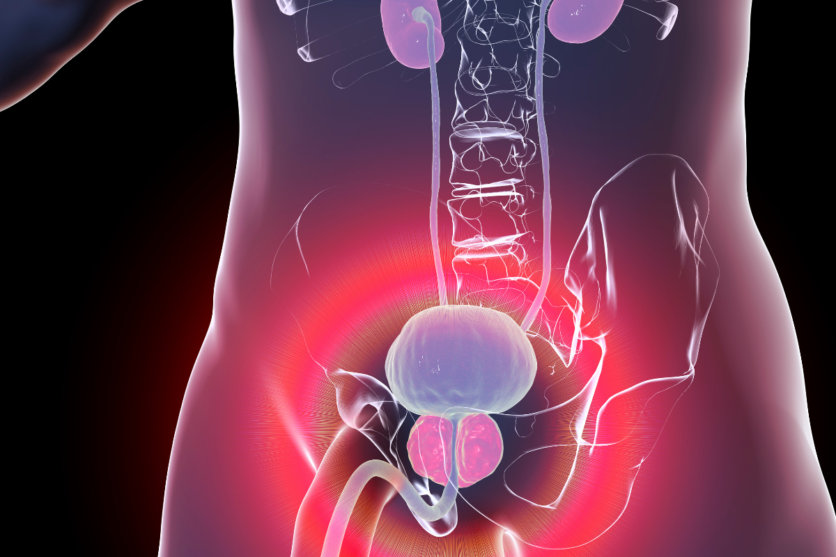 Resultados positivos con disitamab vedotina en el cáncer de vejiga de alto riesgo