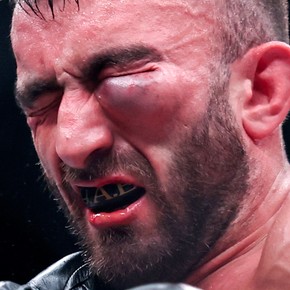 ¡Impactante! Así quedó el ojo de Mohammad Yahya tras recibir una brutal paliza y sufrir siete derribos en la UFC