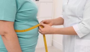 Un nuevo análisis genético predice el riesgo de obesidad adulta desde la infancia