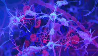 Un estudio explica el papel del intestino en el riesgo de alzhéimer y párkinson