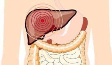 La hepatitis D, la infección del hígado con más riesgo de cáncer