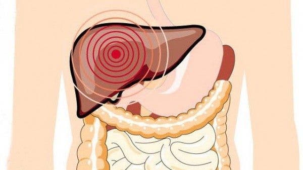 La hepatitis D, la infección del hígado con más riesgo de cáncer