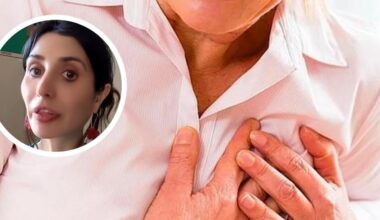 «No son tan claros como en un hombre»