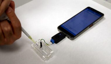Un nuevo test reduce el tiempo para diagnosticar infecciones víricas de horas a minutos