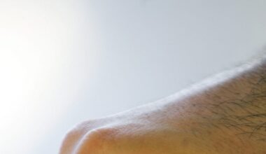 Sanidad advierte de la falta de tranxilium inyectable en los hospitales hasta dentro de un año