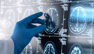 Unos expertos en medicina revelan en Science que los trastornos digestivos duplican el riesgo de Alzheimer y Parkinson