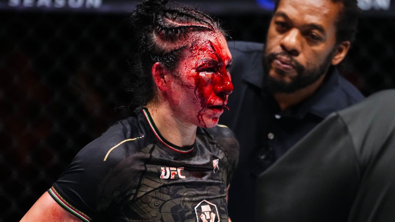Irene Aldana en recuperación de corte espantoso en UFC 306
