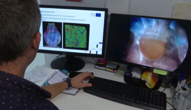 El reto de la regeneración del corazón