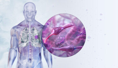 La gripe aviar altera la flora bacteriana de los pulmones y abre la puerta a nuevas infecciones