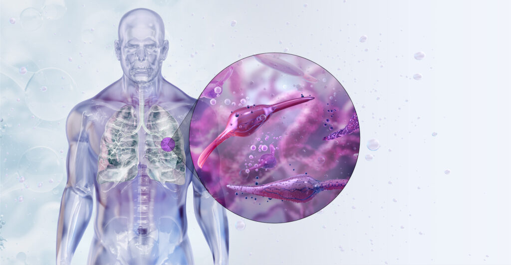 La gripe aviar altera la flora bacteriana de los pulmones y abre la puerta a nuevas infecciones