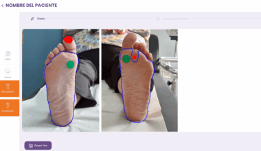 Una app con visión artificial facilita el diagnóstico y seguimiento del pie diabético desde Atención Primaria
