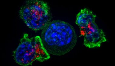 Así se escapa el cáncer de pulmón de los tratamientos