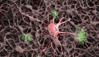 Un investigador señala las señales de advertencia del Alzheimer a las que se debe prestar mucha atención