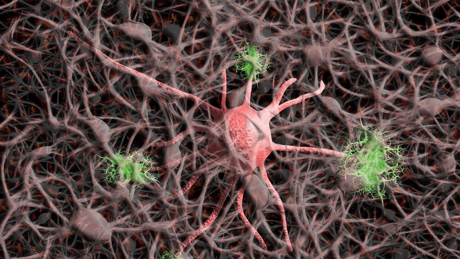 Un investigador señala las señales de advertencia del Alzheimer a las que se debe prestar mucha atención