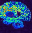 Govind Bhagavatheeshwaran, Daniel Reich, National Institute of Neurological Disorders and Stroke, National Institutes of Health