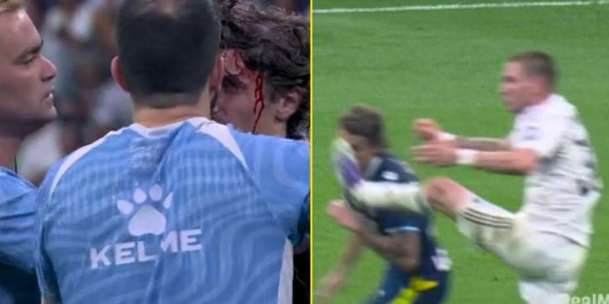 así le dejó la cabeza a Carlos Romero