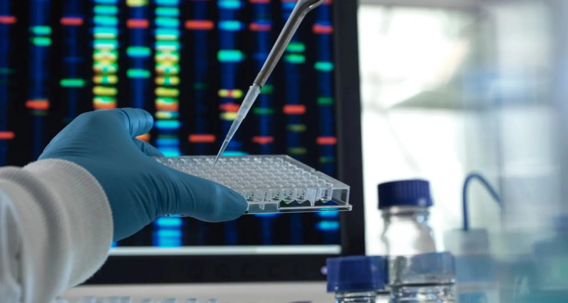 Una nueva terapia génica para el huntington logra ralentizar la progresión de la enfermedad en un 75%