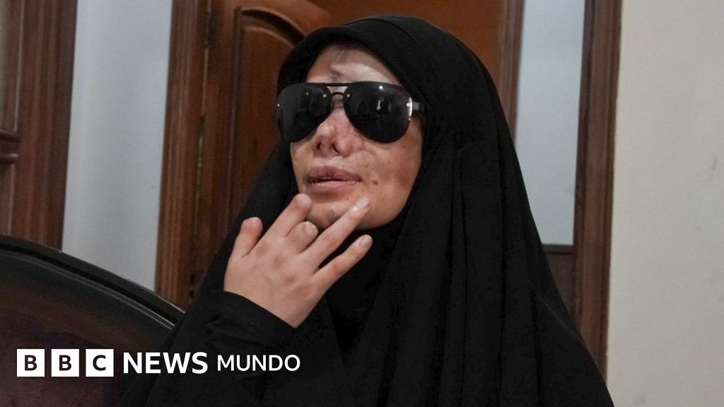 "He perdido los ojos": una víctima del ataque israelí con beepers de hace un año recuerda el mensaje que cegó a decenas de personas en Líbano
