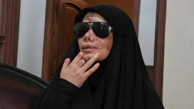 Nayfe lleva gafas de sol que le cubren los ojos y se lleva la mano a la cara. Tiene el pulgar dañado y le falta buena parte de otros dos dedos. Tiene la cara y la nariz dañadas y con cicatrices.