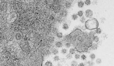 Una vacuna intranasal experimental elimina el virus de la covid-19 en ratones - Servimedia