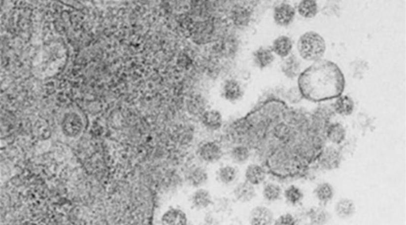 Una vacuna intranasal experimental elimina el virus de la covid-19 en ratones - Servimedia