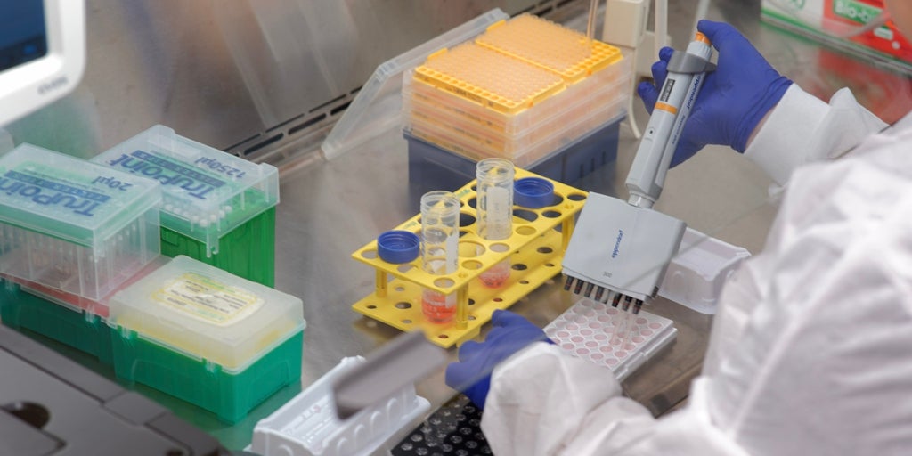 Descubren por qué la gripe es más mortal para las personas mayores