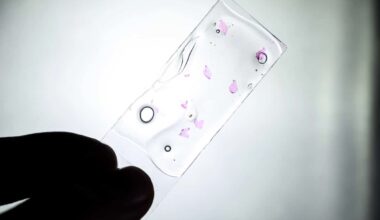 Hallan una nueva vía terapéutica en la lucha contra el cáncer hepático más agresivo