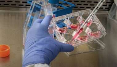 Desarrollan una terapia génica contra el sarcoma de Ewing, un tipo de cáncer infantil