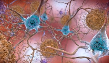 El alzhéimer, ¿una enfermedad infecciosa?
