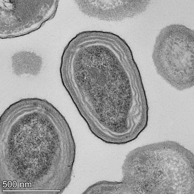 Imagen de microscopio electrónico de varias células de Prochlorococcus. Crédito Natalie Kellogg,