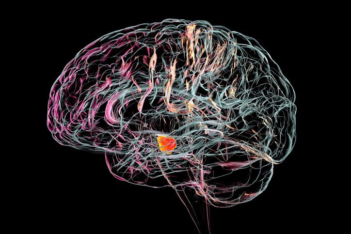 Sustituir neuronas dañadas por el Parkinson, el objetivo de un nuevo ensayo clínico
