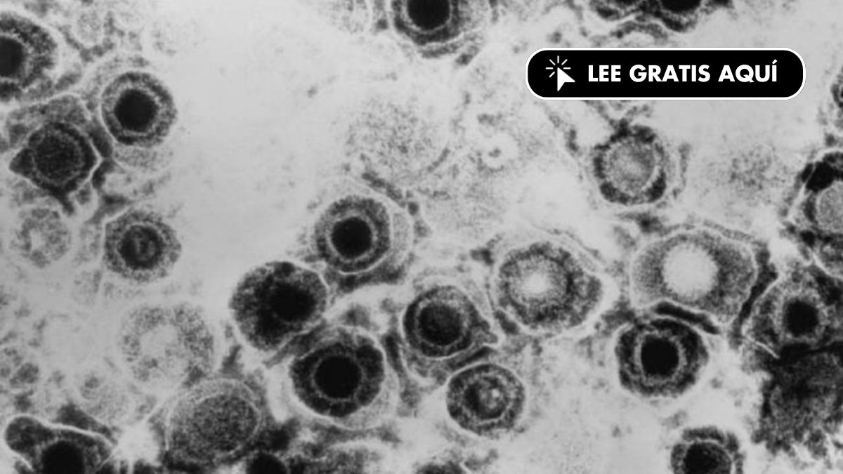 Descubren un antiviral contra el herpes que vence la resistencia a las curas actuales