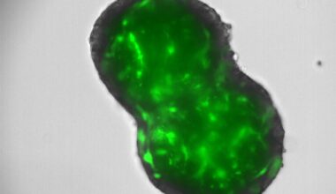 setanaxib-colangiocarcinoma