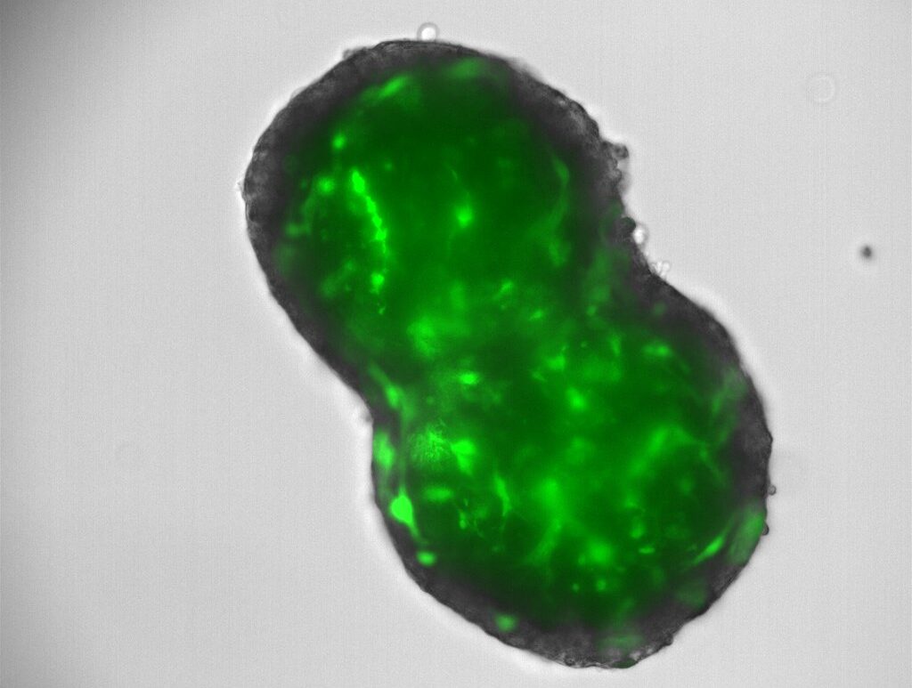 setanaxib-colangiocarcinoma