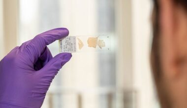 Un único fármaco podría ser una terapia casi universal para una enfermedad rara