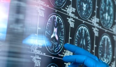 "Es un hito histórico": los dos grandes avances contra el alzhéimer que abren una nueva era de la lucha contra la enfermedad | Ciencia y tecnología