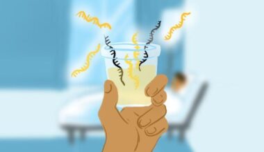 Nueva prueba de orina detecta cáncer de próstata - diagnostico-molecular