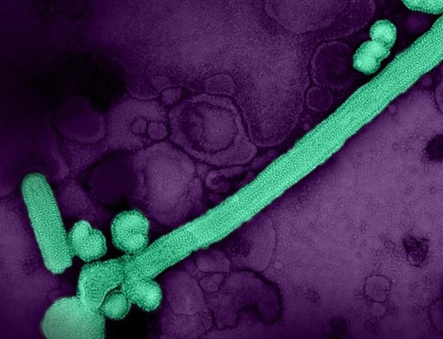 Virus-gripe-A-H3N2-ISCIII