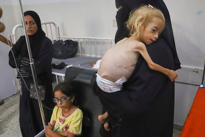 La niña palestina de dos, Shamm, gravemente desnutrida, en brazos de su madre en el hospital Nasser de Jan Yunis, en Gaza, el pasado 9 de agosto. 