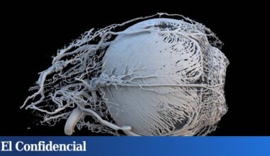 El tratamiento (barato) para corregir la miopía sin láser ni cirugía está más cerca que nunca