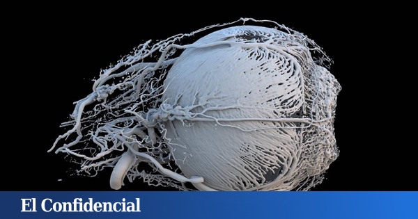 El tratamiento (barato) para corregir la miopía sin láser ni cirugía está más cerca que nunca