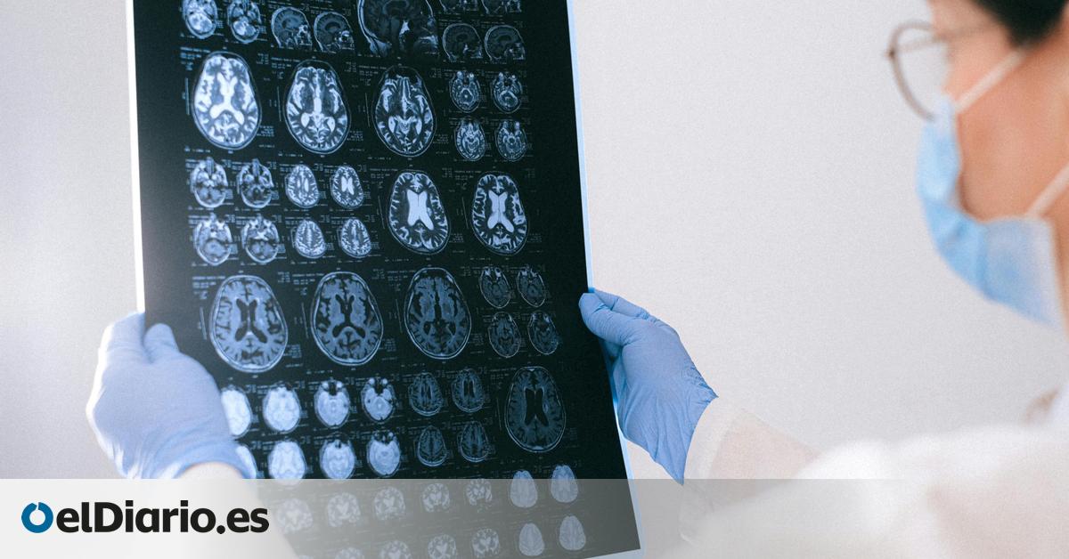 Pacientes con la enfermedad de Huntington son tratados por primera vez con éxito mediante terapia génica