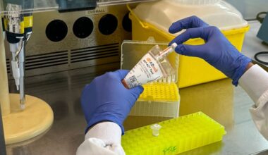 Primer biomarcador en sangre capaz de anticipar la progresión hacia el alzhéimer