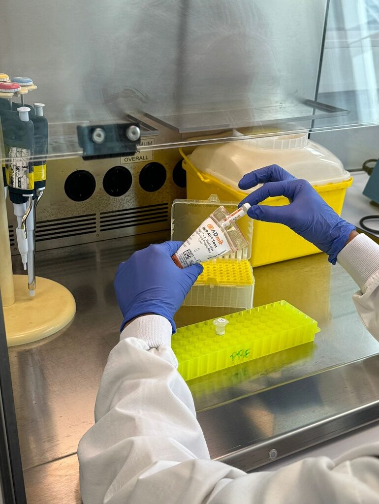 Primer biomarcador en sangre capaz de anticipar la progresión hacia el alzhéimer
