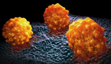 Un algoritmo ayuda a predecir metástasis en cáncer de páncreas y evitar cirugías innecesarias