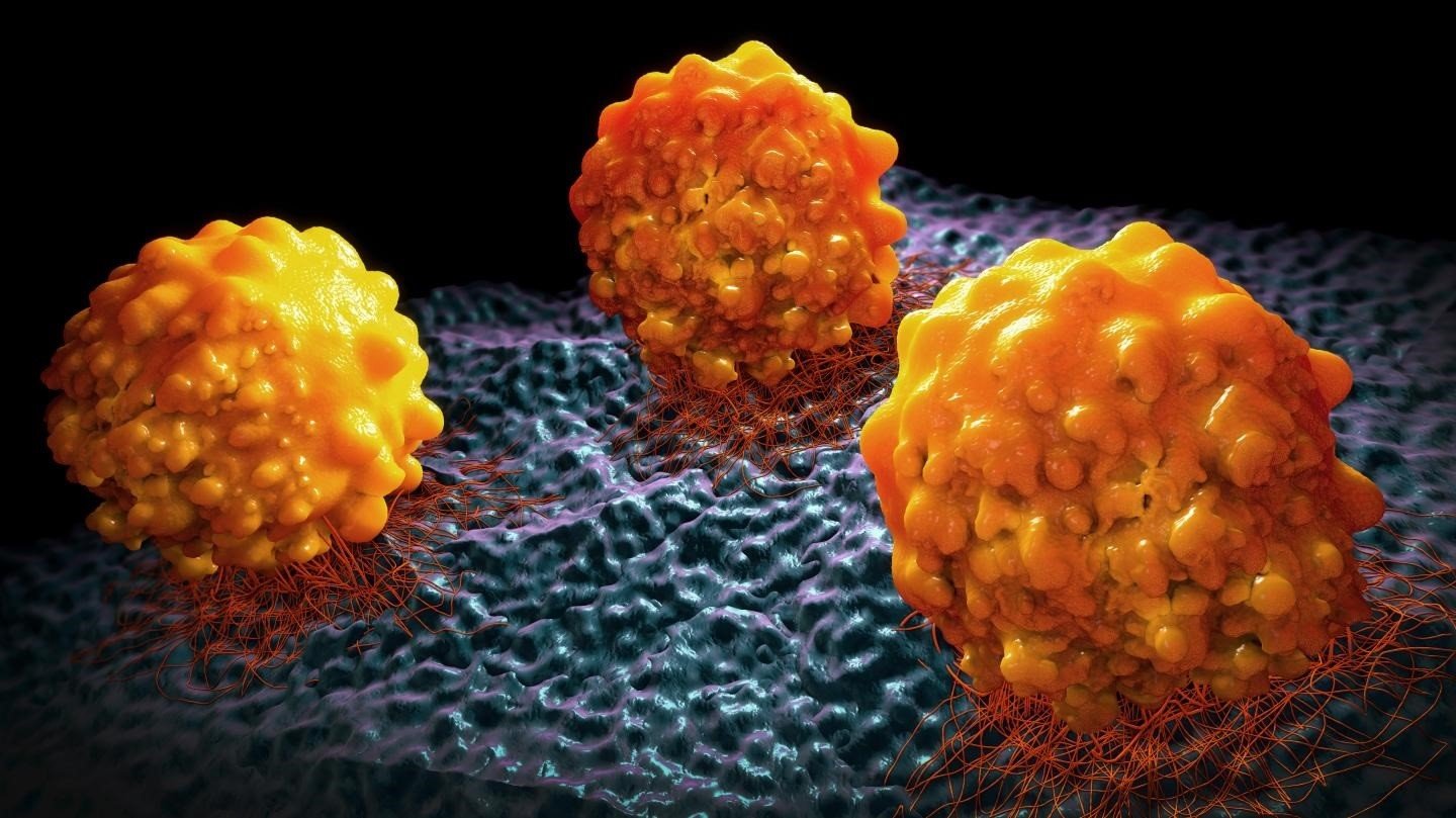 Un algoritmo ayuda a predecir metástasis en cáncer de páncreas y evitar cirugías innecesarias