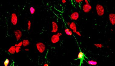 La enfermedad mental y el alcohol frenan la capacidad para generar nuevas neuronas