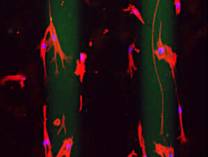 La durotaxis, clave en la metástasis del cáncer de páncreas