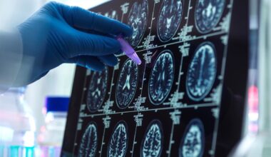 El 89% de los expertos cree que la falta de tiempo en consulta dificulta el diagnóstico temprano del Alzheimer